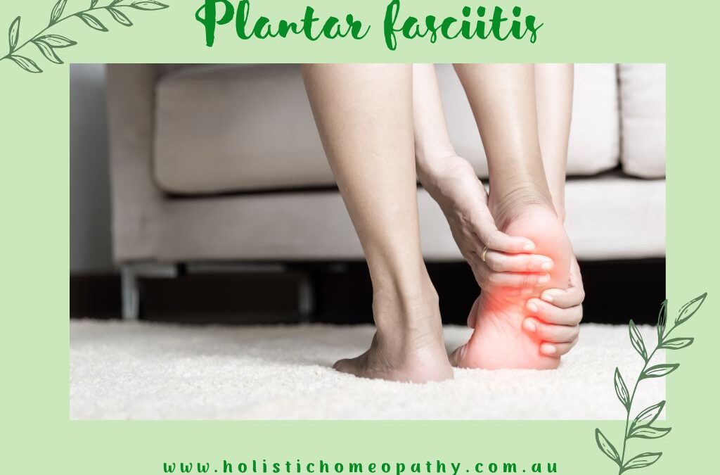 Homeopathic Support for Plantar Fasciitis