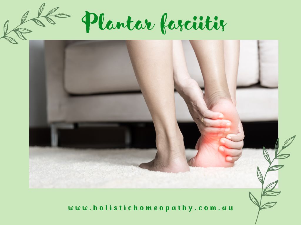 Homeopathic Support for Plantar Fasciitis